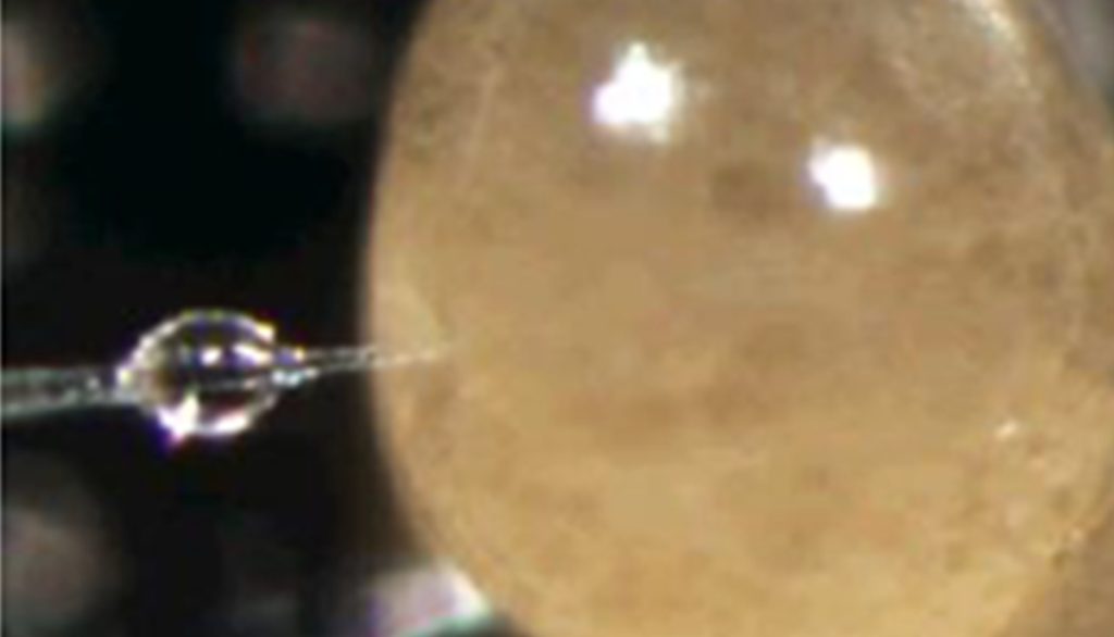 A researcher injects a tick embryo under the microscope.